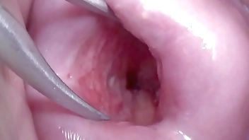 Japanese Wife Open Cervix Wide to watch inside Uterus