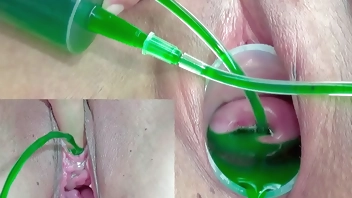 Cervix and Pee Hole Inflation with Injections for Japanese Lesbians