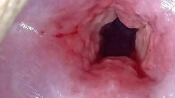 Uncensored Japanese Cervix Stretching and Uterus Dilation with Penetration